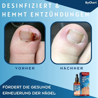 ToePerfect | Heal Nails Fast, Live Pain-Free | 50% Off