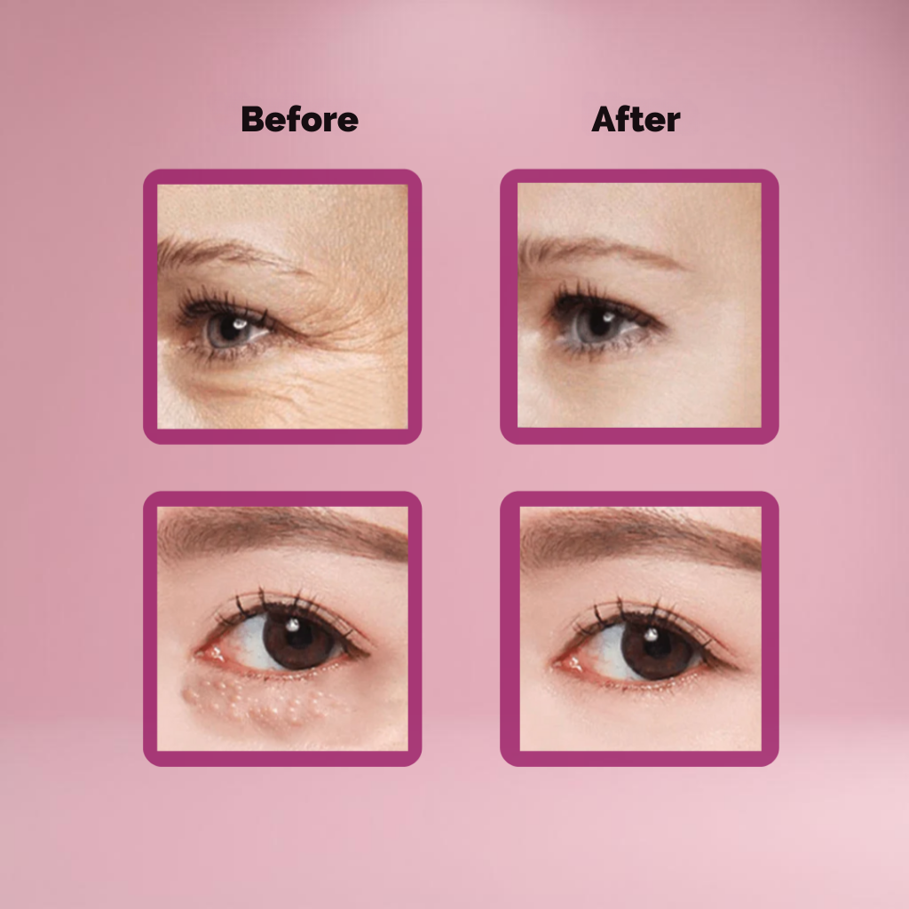 EyeVance™ — Instantly Lift and Brighten Tired Eyes for Youthful, Radiant Confidence