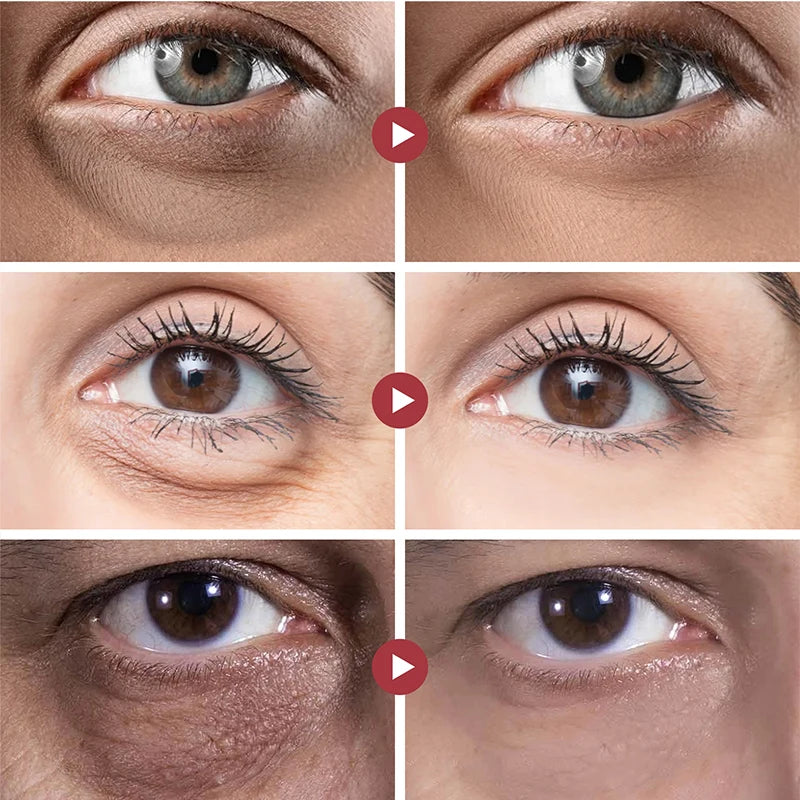 LumenaLift™ — Ignite Youthful Eyes That Command Attention Instantly