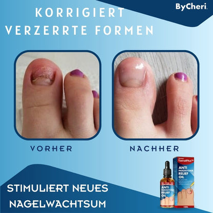 ToePerfect | Heal Nails Fast, Live Pain-Free | 50% Off