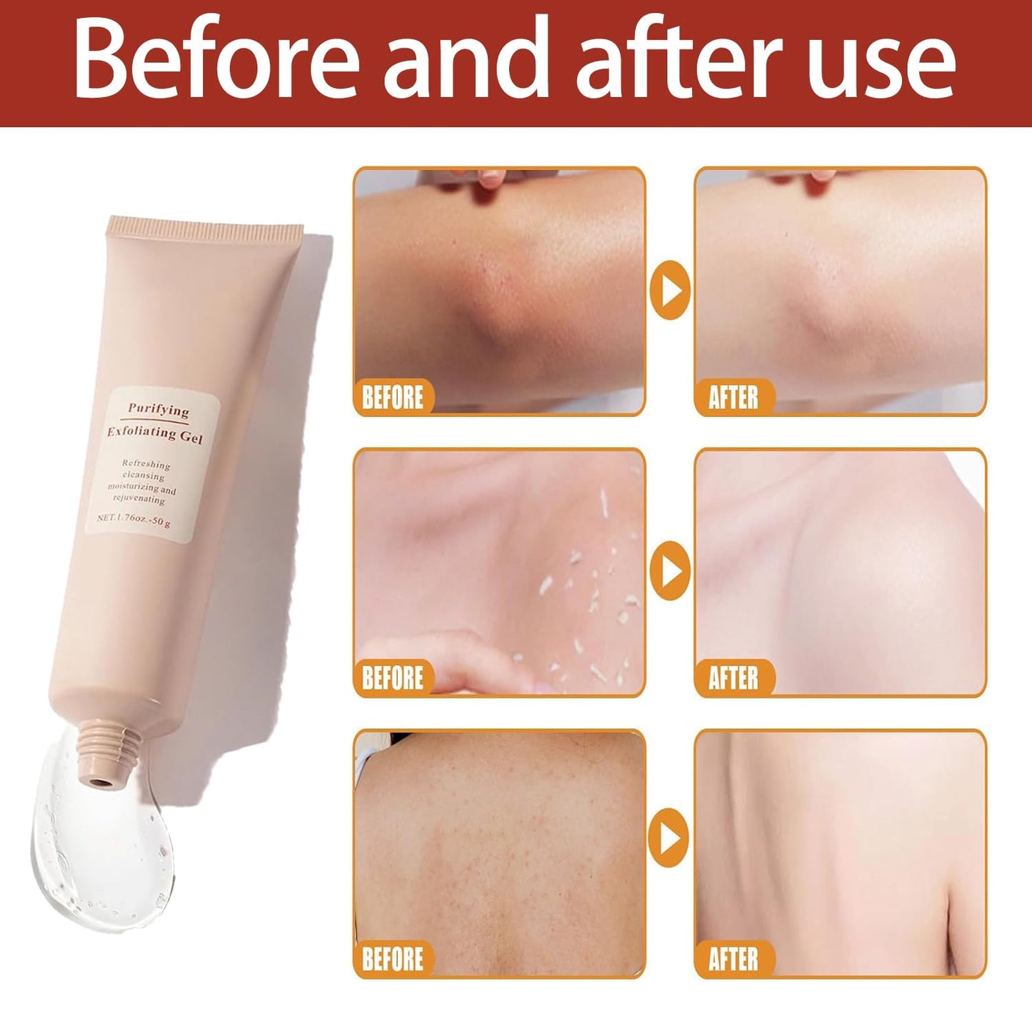 ClearSkin Peeling Gel – Achieve Radiant Skin in Just 1 Minute!