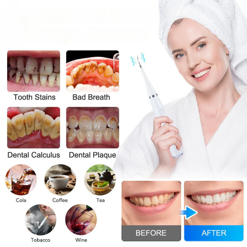 SmileBlast™ — Deep Clean for a Radiant Smile | 50% Off