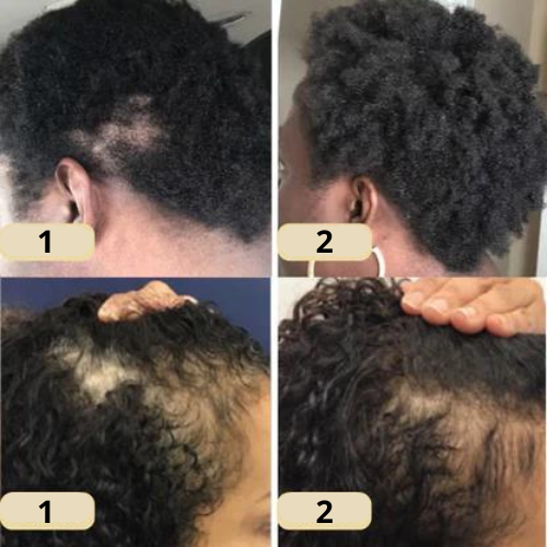 HerbaFleur™ — Unlock Bold, Lush Hair That Commands Every Room