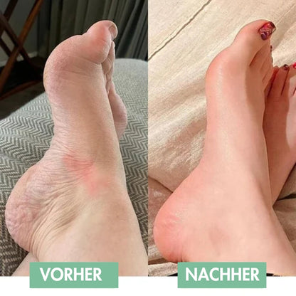 ReliefPad™ – The Cutting-Edge EMS Foot Massager for Immediate Relief!