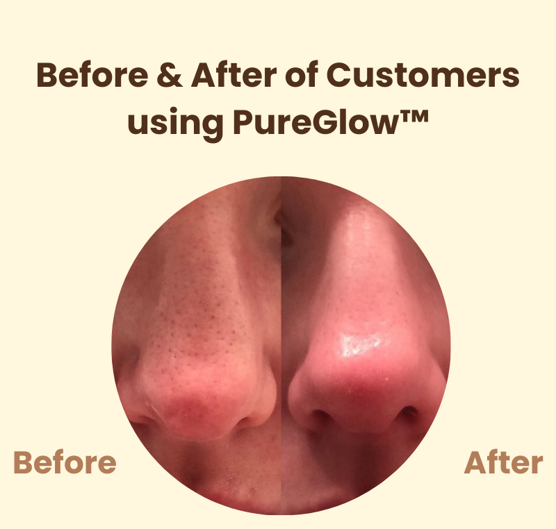 PureGlow™ – Luminous Skin
