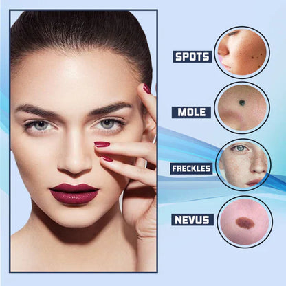 SpotClear | Zap Dark Spots Pain-Free & Fast | 50% Off