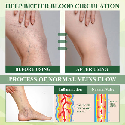 VascuRelief™ — Banish Swelling and Rediscover Effortless Freedom
