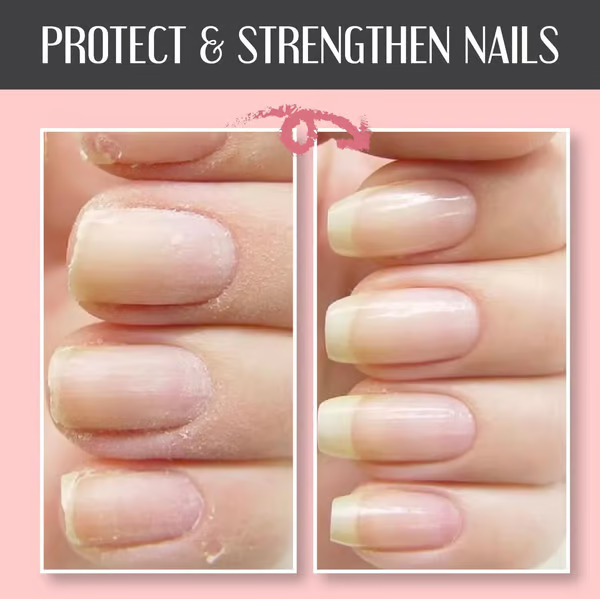 RevitaNail™ — Instantly Repair and Strengthen Nails for a Dazzling, Confident Glow