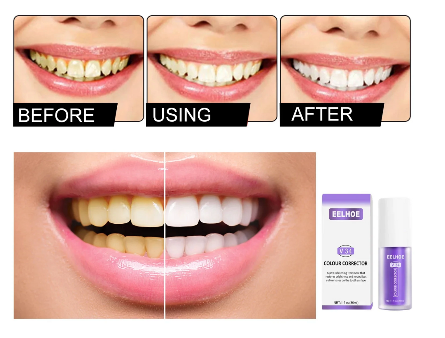 Brillora™ — Unlock an Instant, Pain-Free Smile That Turns Heads Everywhere