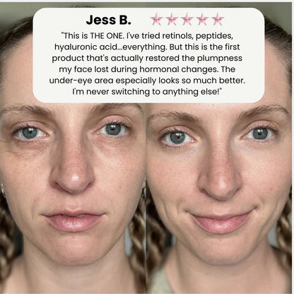 VivaDerm™ — Instantly Lift and Radiate Confidence with Youthful, Plump Skin