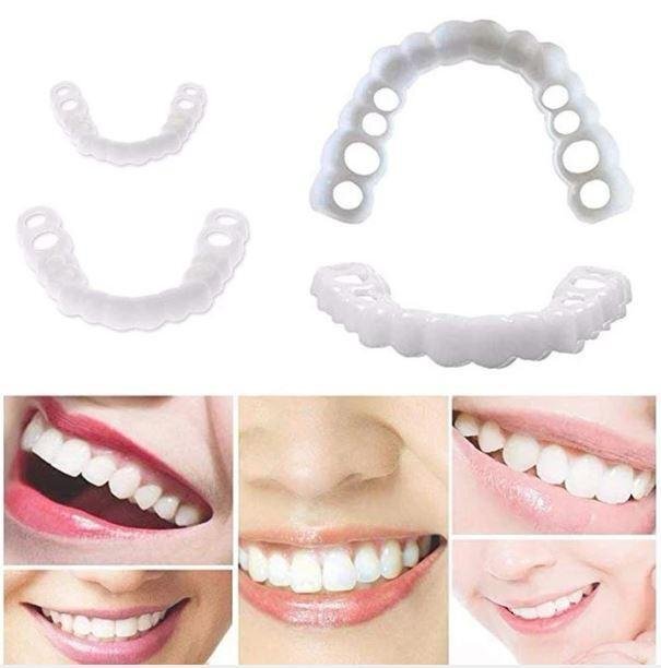 Snap-On Removable Dentures