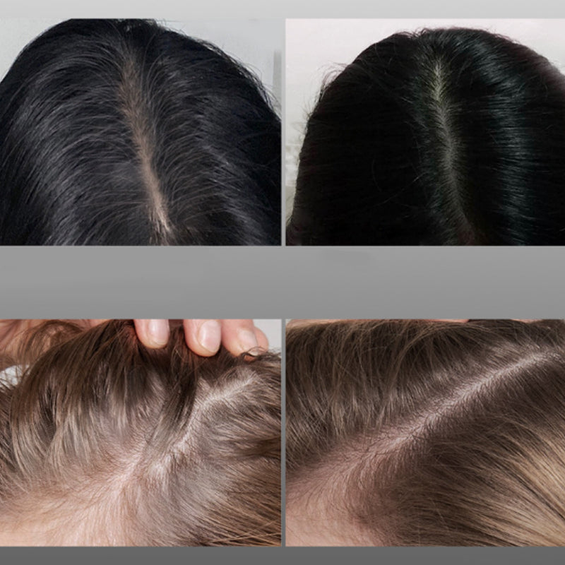 Voltaris™ — Erase Gray Instantly for a Younger, Sharper You