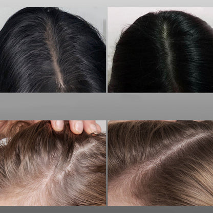 Voltaris™ — Erase Gray Instantly for a Younger, Sharper You