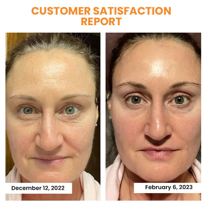 PurexaSkin™ — Reveal Firmer, Radiant Skin That Feels Youthfully Plump Every Day