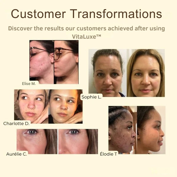 RadiantBloom™ Detox Mask — Reveal Stunningly Clear, Youthful Skin That Lights Up Your Confidence