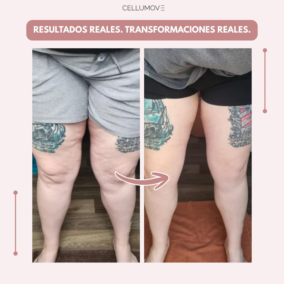 VitaStride™ — Feel Energized Legs and Say Goodbye to Swelling All Day