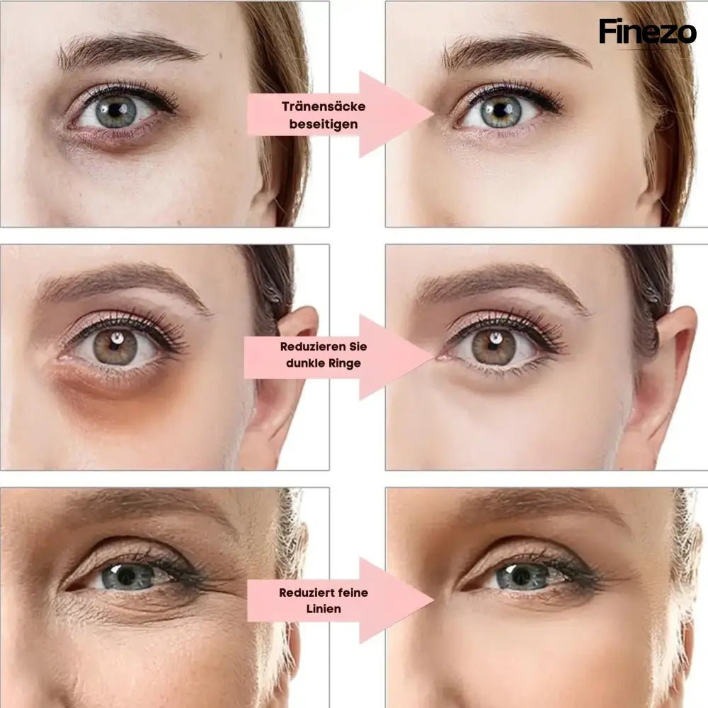 Glameyes™ | Eye Revitalizer – Achieve Radiant, Awake Eyes Free from Dark Circles! | 50% OFF