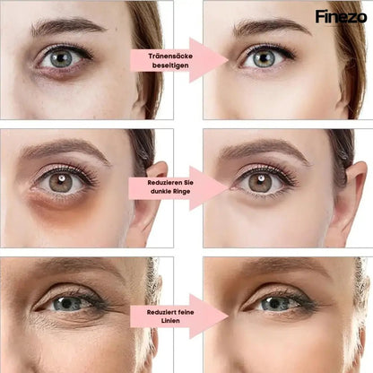 Glameyes™ | Eye Revitalizer – Achieve Radiant, Awake Eyes Free from Dark Circles! | 50% OFF