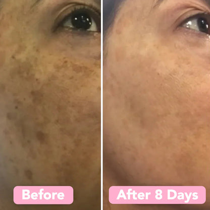 LumaLift™ Elixir Pads — Wake Up to Radiant, Silky Skin That Steals Every Glance