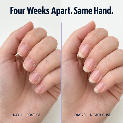 VitaNail™ — Restore Post-Gel Nails Using This 3-in-1 Buffer Oil Pen