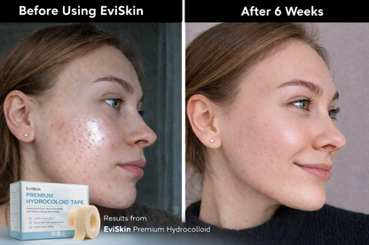 Clearlynx™ — Triple-Strength Power That Clears Pimples and Unleashes Your Radiant Confidence