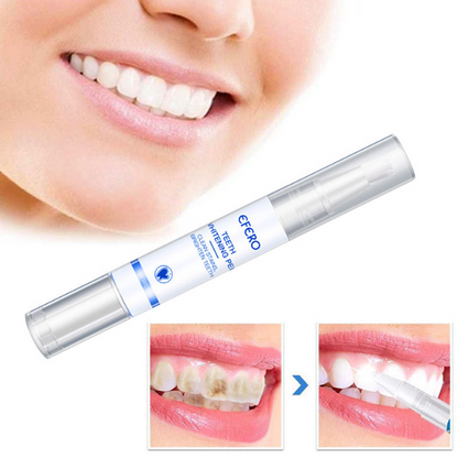GlowWhiten | Teeth Whitener
