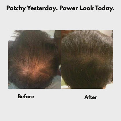 FluffUp™ — Instantly Conceals Hair Loss for a Fuller, Younger Look | Now 50% OFF + Ships Free