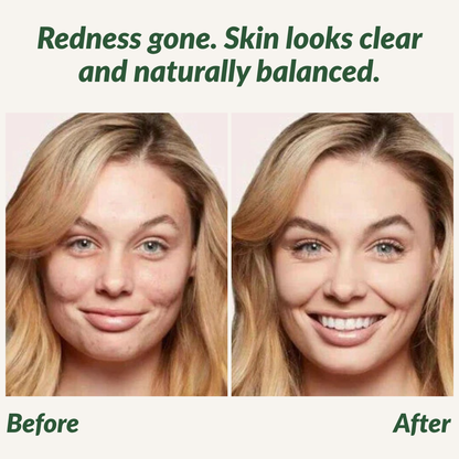 GlowMist™ — Unlock Stunning, Weightless Radiance That Feels Like Your Own Skin