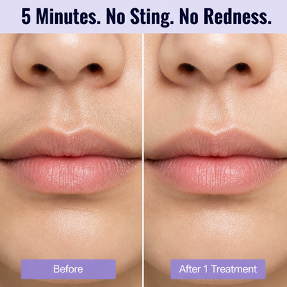 VelvetSheer™ — Remove Peach Fuzz Fast Without Irritation or Chemical Odor