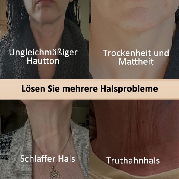 NeckLuxe™ — Unleash a Firmer, Silkier Neck That Radiates Youthful Confidence