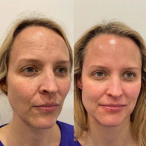 GlowMaster™ — Effortless, Radiant Skin That Turns Heads Instantly