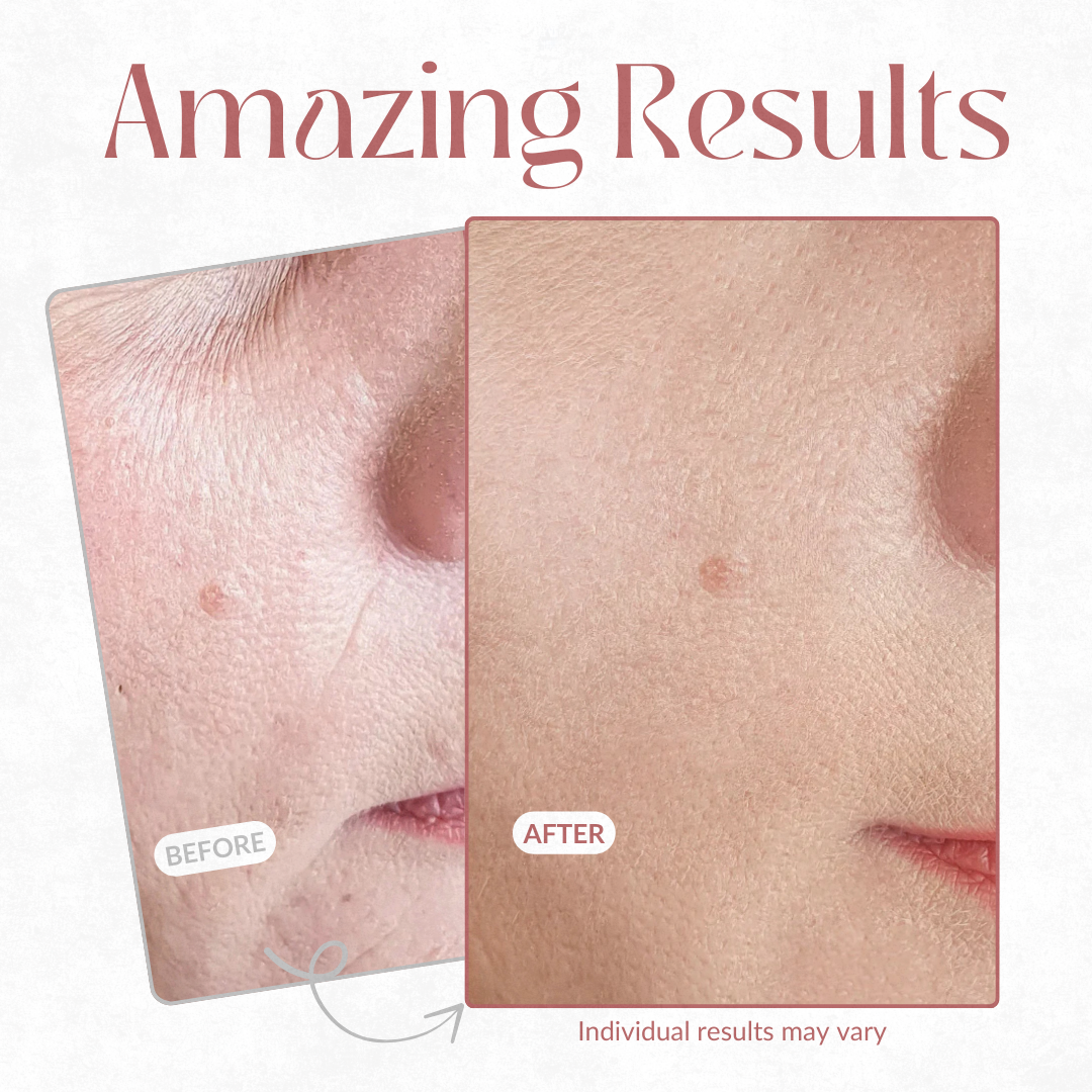 LumoraLift™ — Instantly Firm, Hydrate, and Glow with Youthful Confidence Every Day