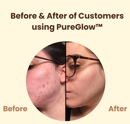 PureGlow™ – Luminous Skin