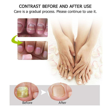 EverNail™ — Reveal Strong, Stunning Nails That Command Attention in Just One Week
