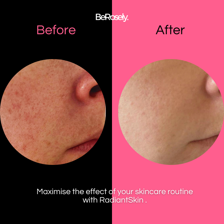 RadiantSkin™ Gentle Shower Brush