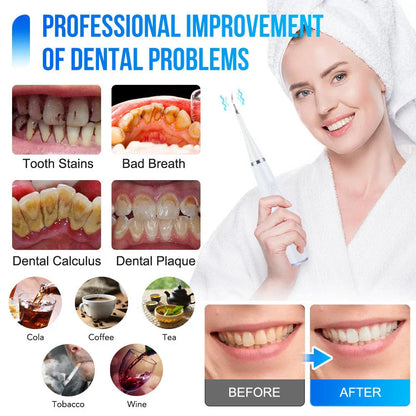 RadianceWave™ — Unlock a Brilliant Smile That Commands Attention and Boosts Your Confidence