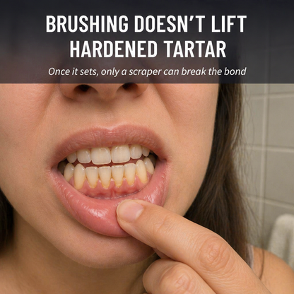 ShinePulse™ — Remove Tartar and Lighten Stains Between Dental Visits