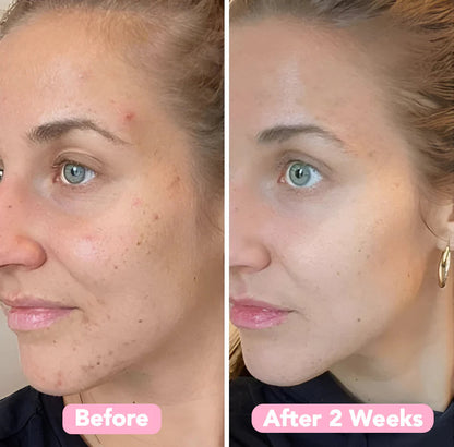 LumaLift™ Elixir Pads — Wake Up to Radiant, Silky Skin That Steals Every Glance