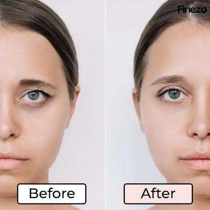 Glameyes™ | Eye Revitalizer – Achieve Radiant, Awake Eyes Free from Dark Circles! | 50% OFF