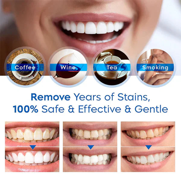 BrightSmile™ — Whiten Fast, No Sensitivity | 50% Off
