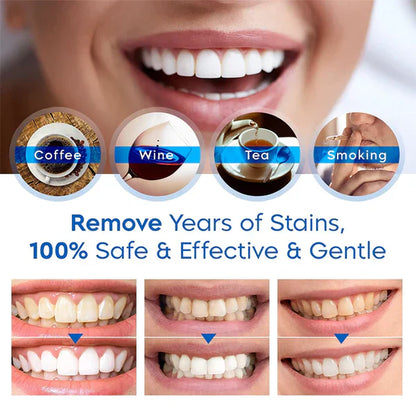 BrightSmile™ — Whiten Fast, No Sensitivity | 50% Off