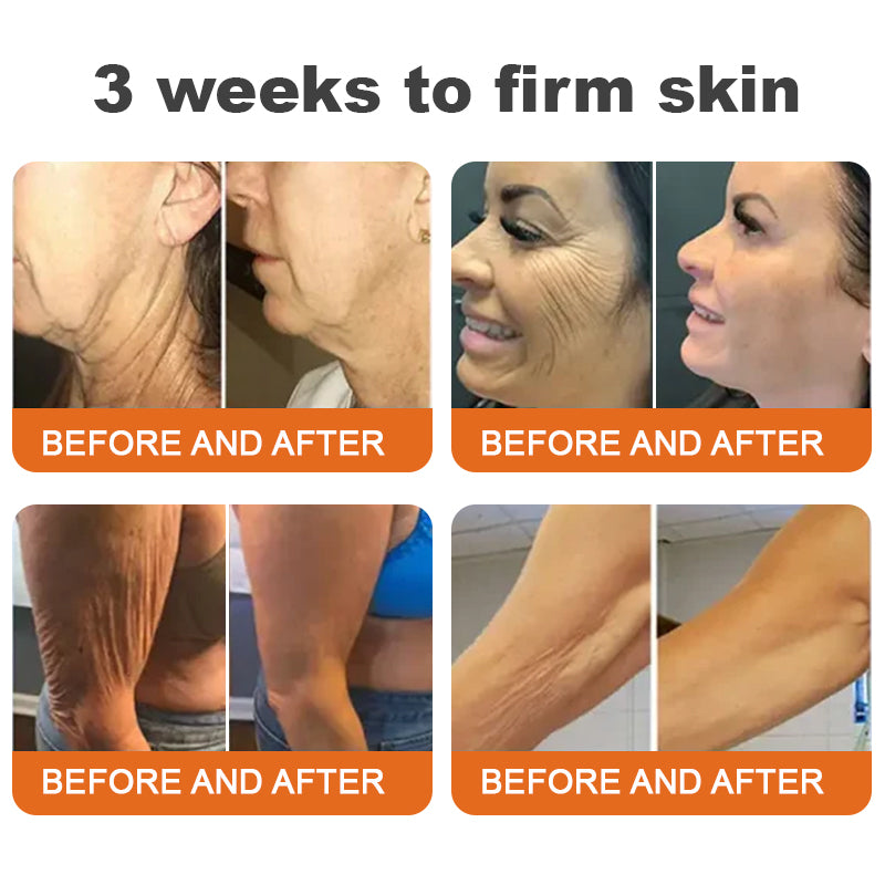 TLOPA™ Botox Bee Venom Serum — Erase Wrinkles, Reclaim Youth | 50% Off