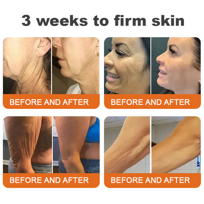 TLOPA™ Botox Bee Venom Serum — Erase Wrinkles, Reclaim Youth | 50% Off