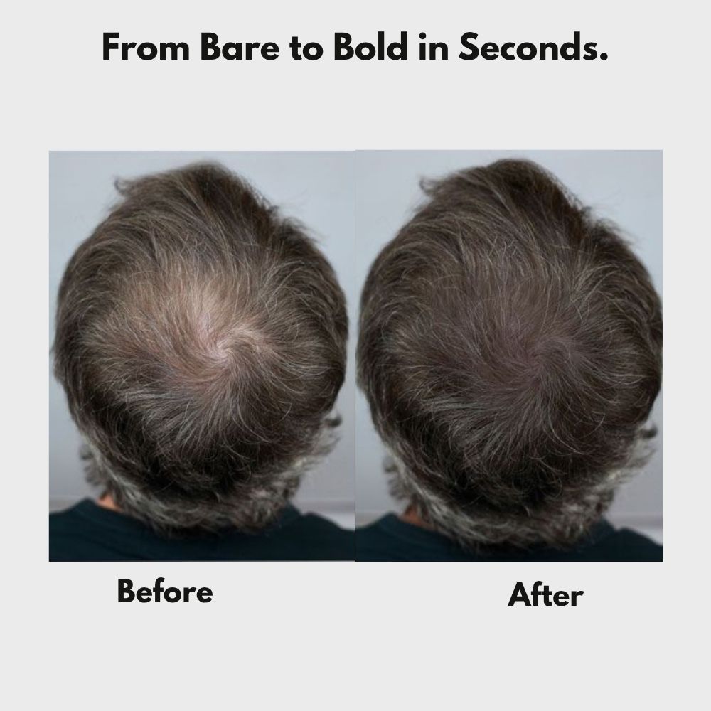 FluffUp™ — Instantly Conceals Hair Loss for a Fuller, Younger Look | Now 50% OFF + Ships Free