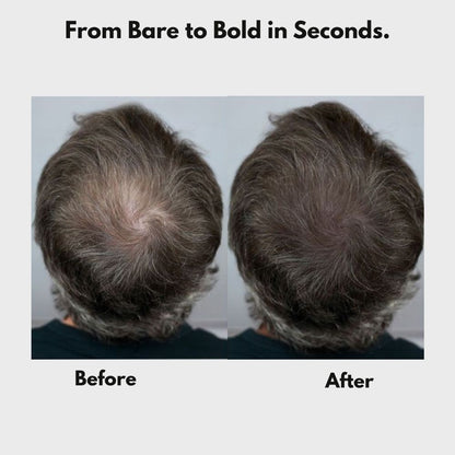 FluffUp™ — Instantly Conceals Hair Loss for a Fuller, Younger Look | Now 50% OFF + Ships Free