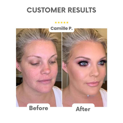 VeAura™ — Effortless Radiance That Transforms Your Skin Instantly