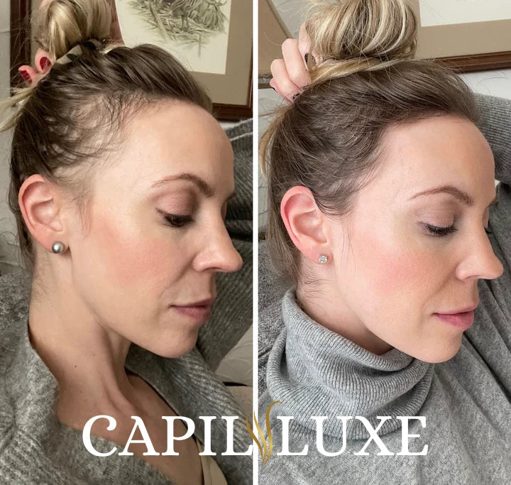 VoluLuxe™ — Unleash Lush, Head-Turning Volume Instantly