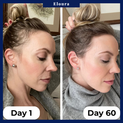 CrownMist™ — Unlock Fuller, Thicker Hair That Boosts Your Confidence Every Day
