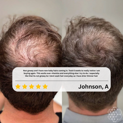 CrownMist™ — Unlock Fuller, Thicker Hair That Boosts Your Confidence Every Day