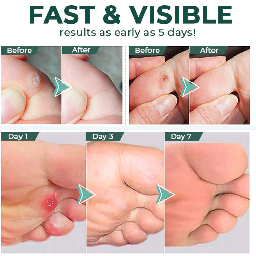 SilkStride™ — Melt Away Painful Calluses for Baby-Soft Feet You’ll Crave to Show